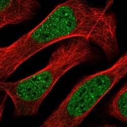 ZNF613 Antibody, Novus Biologicals:Antibodies:Primary Antibodies